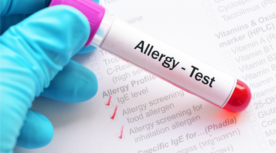 Are Home Allergy Tests Reliable?